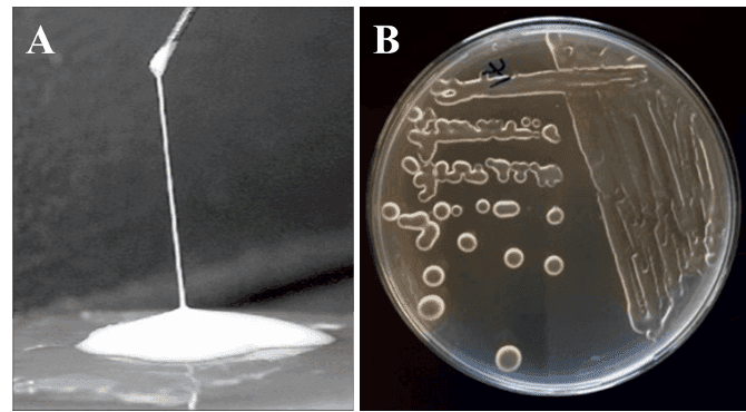 Soutenance de Thèse de Doctorat en Molécule Bioactives, Santé et Biotechnologies et Ingénierie Tissulaire par Madame Sihame AKHTACH